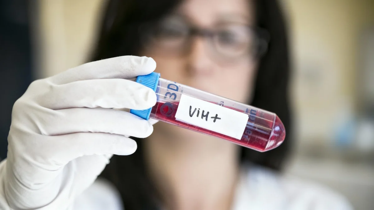 Más de 1.4 millones de personas con VIH reciben tratamiento