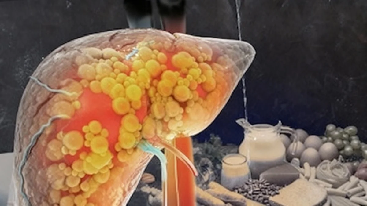 Nutrientes esenciales para combatir el hígado graso