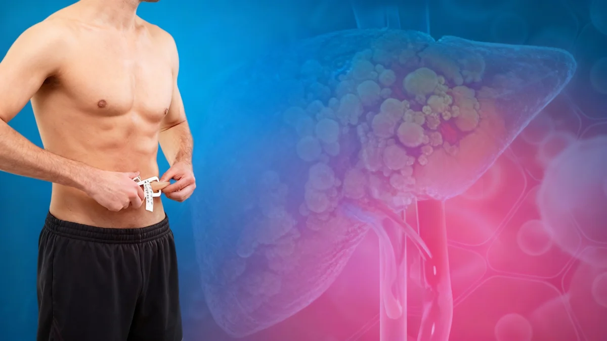 Pérdida de peso: clave para revertir el hígado graso