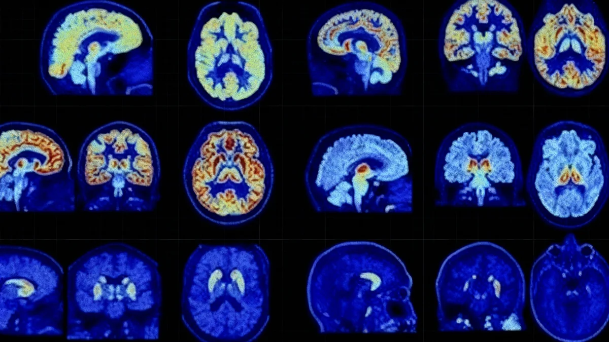 Yale presenta NeuroEXPLORER, un escáner cerebral de alta precisión